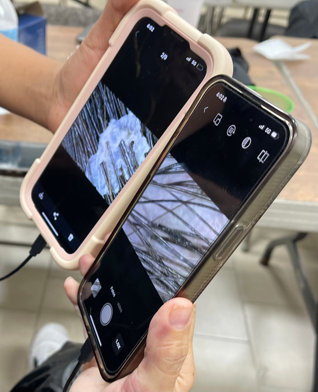 Hair & Scalp Zoom Camera – 1600X with LED Lights